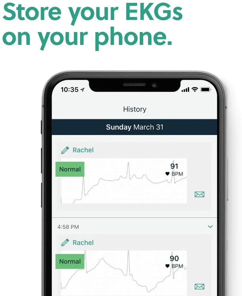 AliveCor KardiaMobile Personal EKG | FDA-Cleared | Detects AFib