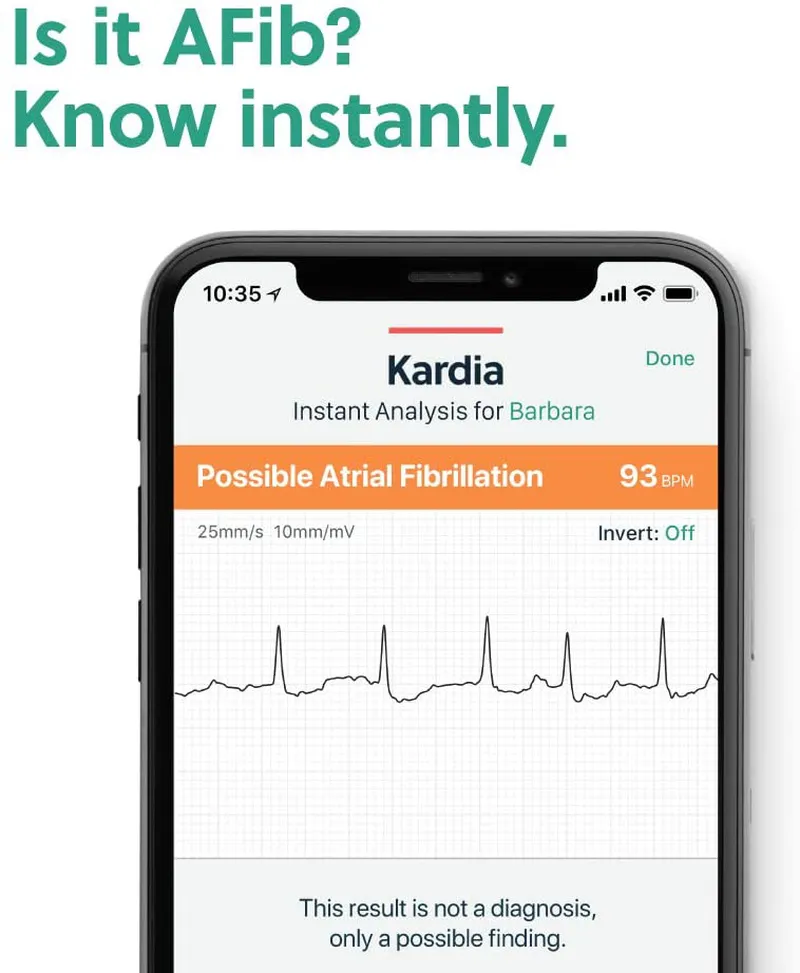 AliveCor KardiaMobile Personal EKG | FDA-Cleared | Detects AFib